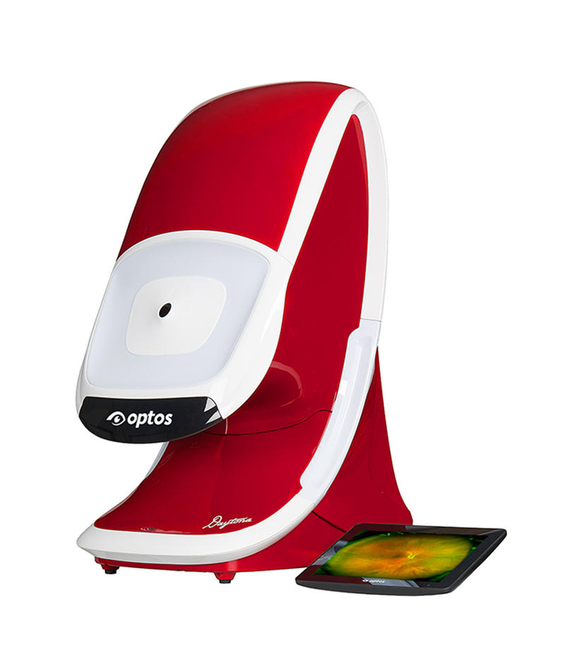 英國(guó)全景激光掃描眼底照相